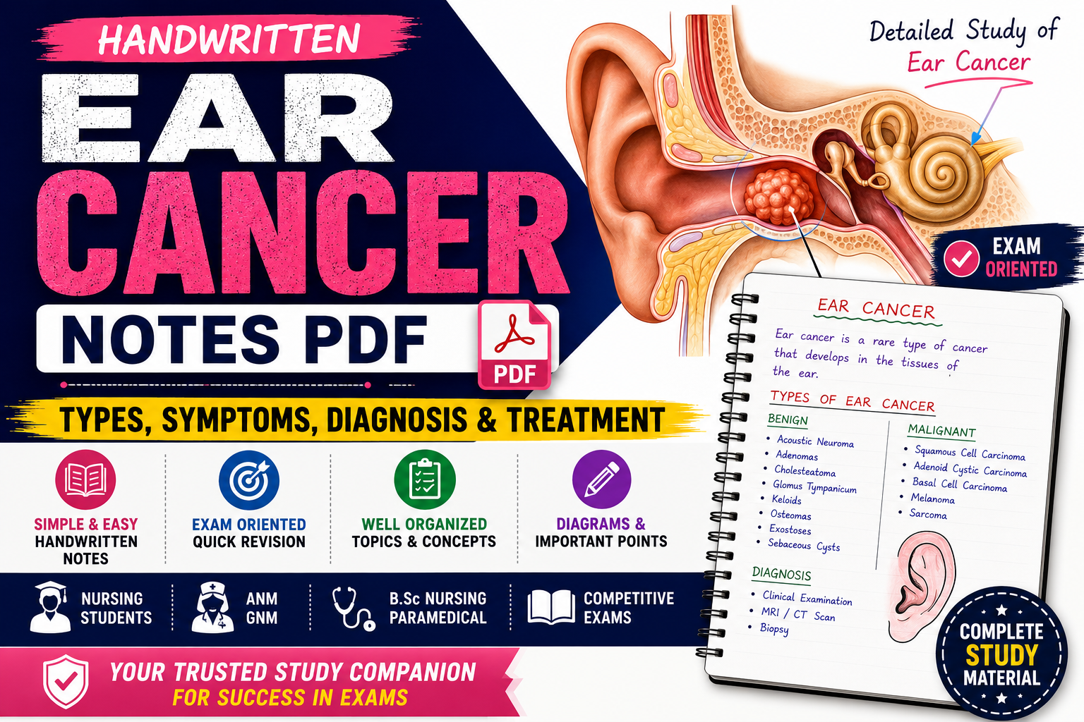 Ear Cancer Handwritten Notes PDF Download - Types, Symptoms, Diagnosis & Treatment thumbnail